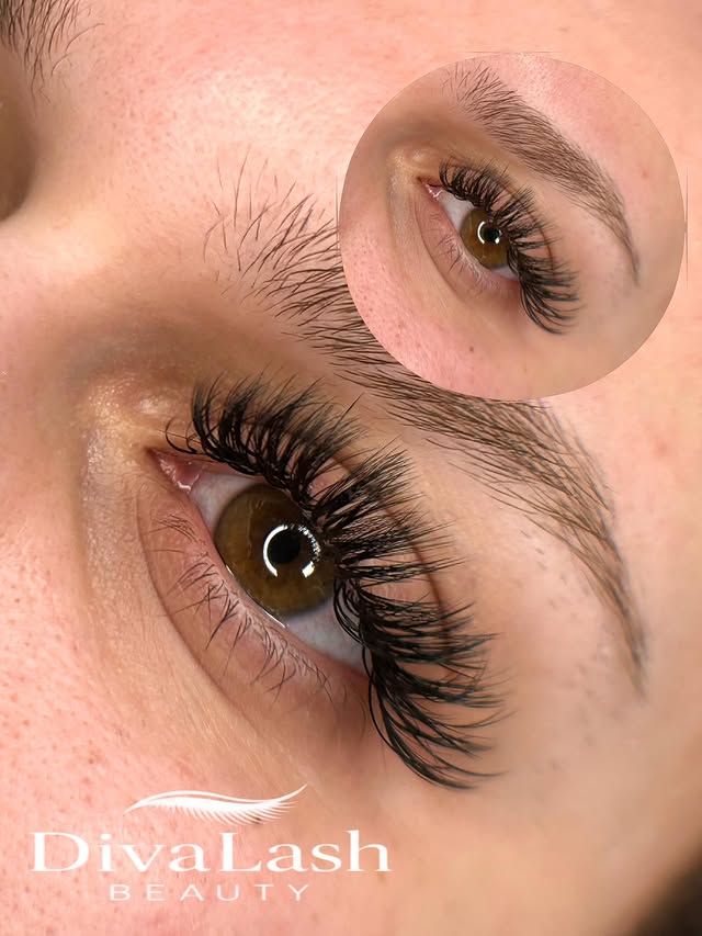 Hybrid Set Ergebnis